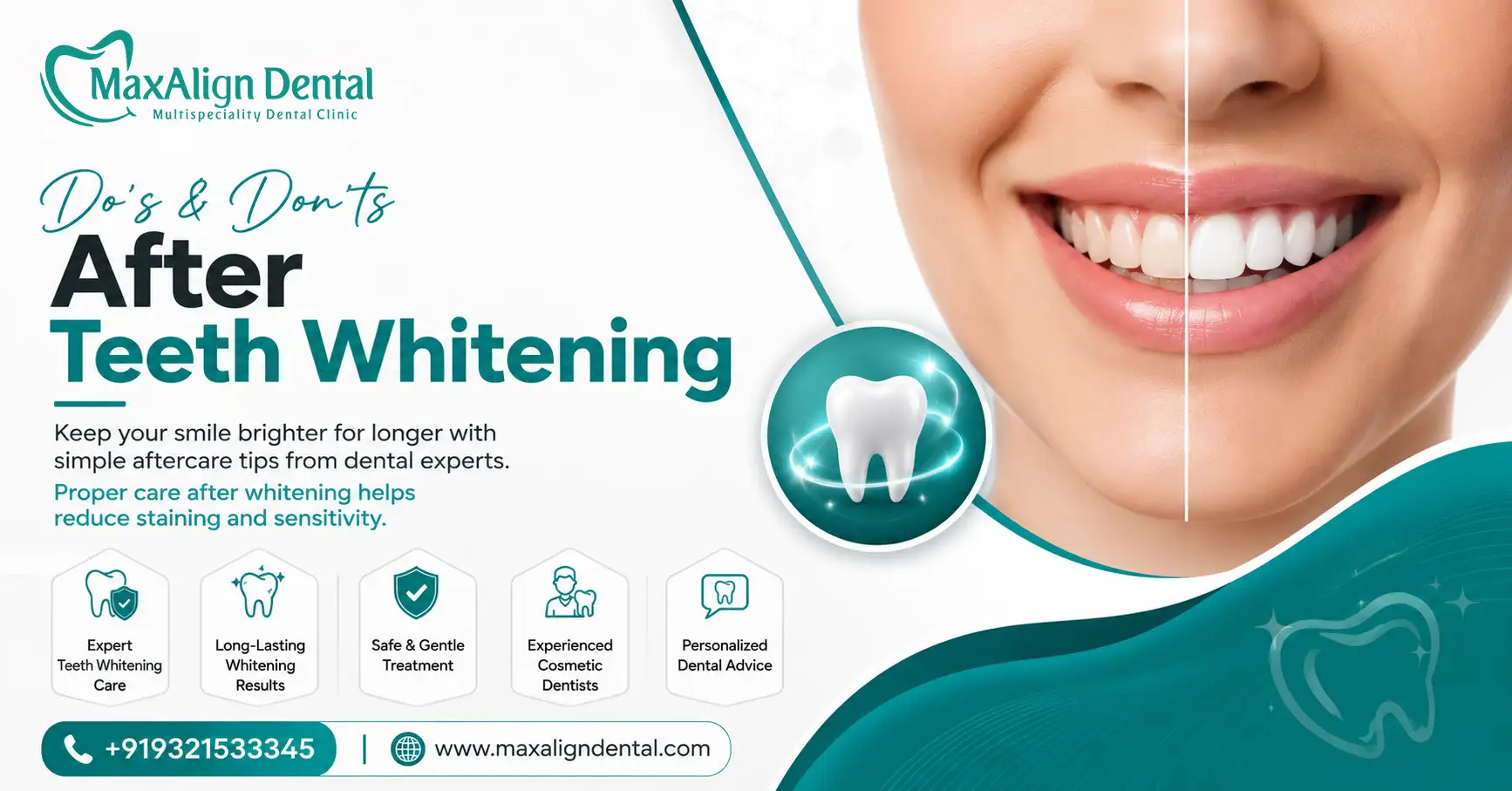 Dental Clinic for Tooth Pain in Marathahalli
