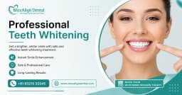 Top 5 Benefits of Professional Teeth Whitening