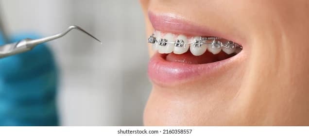 Dental Implants Banner