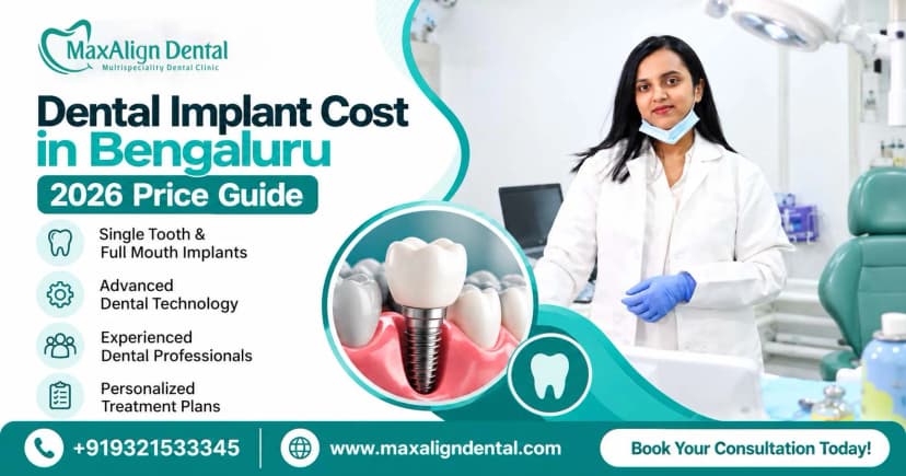 How Much Do Dental Implants Cost in Bengaluru? (Factors That Affect Price) – MaxAlign Dental – 3 Oct 2026