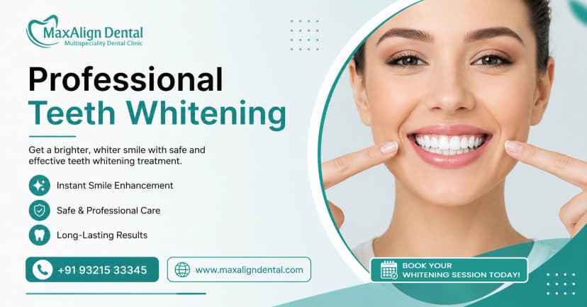 Top 5 Benefits of Professional Teeth Whitening