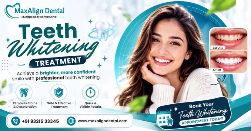Why Winter is the Best Time to Have Teeth Whitening in Bangalore